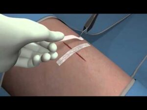 puntos-de-aproximacion-mercadona